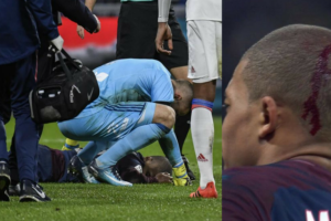 Lesion de mbappe del psg tras chocar con el arquero del lyon